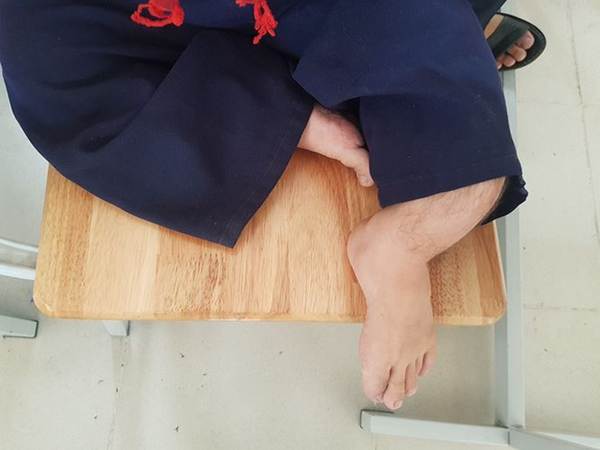 Nghị lực đến trường của nam sinh tí hon 18 tuổi, nặng 20kg-2