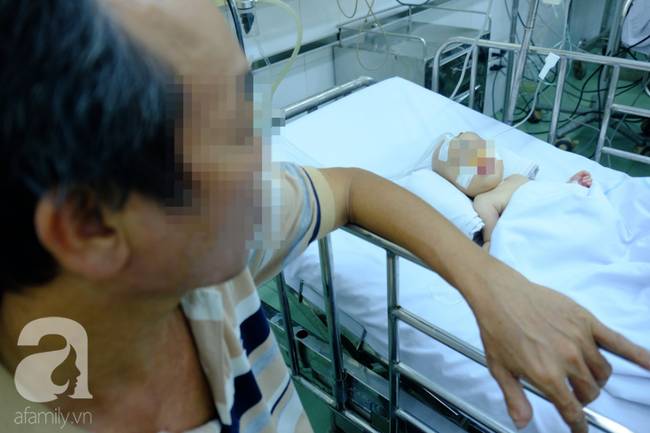 Phụ huynh rối bời vì trẻ bị tay chân miệng ở TP.HCM tăng gấp 5 lần-5