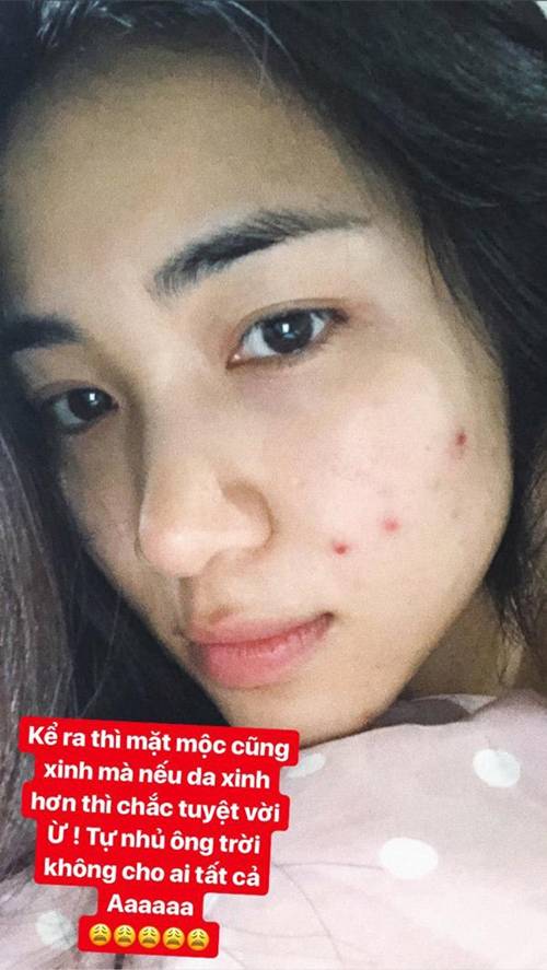 Đăng ảnh khoe dáng, fan lo lắng nhận xét Hòa Minzy đang gầy đến thảm thương!-9