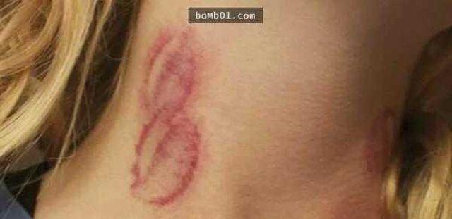 Chàng trai trẻ bị co giật và tử vong, dấu vết trên cổ tố cáo thủ phạm khó ngờ-2