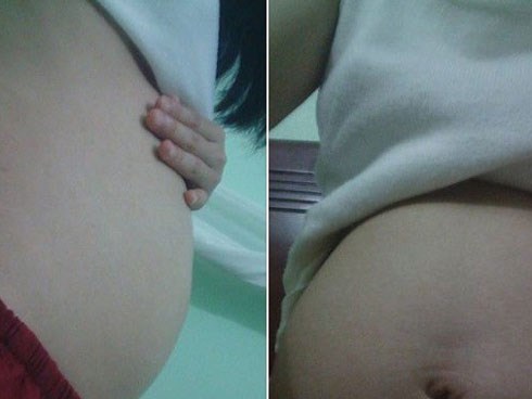 Kể khổ bầu 18 tuần chẳng thấy bụng, nhờ mẹ chồng mua đồ tẩm bổ không được, cô gái lại bị chị em mắng te tua