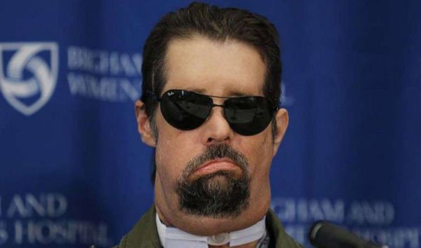 Bị vợ bỏ vì quá xấu, người chồng ghép mặt 8 năm trước giờ ra sao?-3