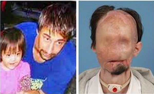 Bị vợ bỏ vì quá xấu, người chồng ghép mặt 8 năm trước giờ ra sao?-1