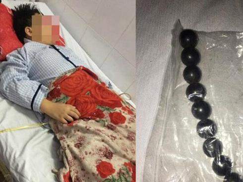 Vụ đứa trẻ bị bạn ép nuốt 9 viên bi nam châm: Hãy dạy trẻ cách yêu bản thân-1