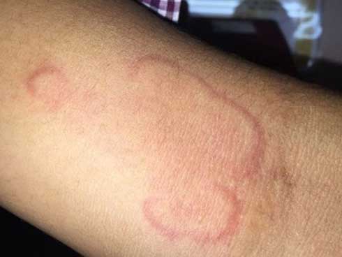 Thường xuyên chăm hoa, người phụ nữ hốt hoảng vì ho khạc ra giun lúc nhúc-1