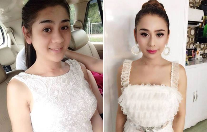Sau khi dao kéo sao Việt nhìn ra sao nếu không photoshop, make up?-1