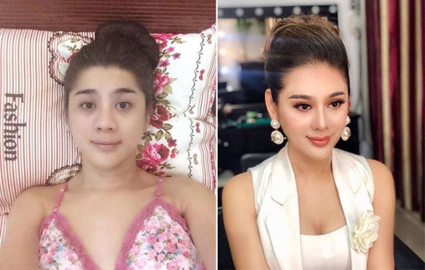 Sau khi dao kéo sao Việt nhìn ra sao nếu không photoshop, make up?-3