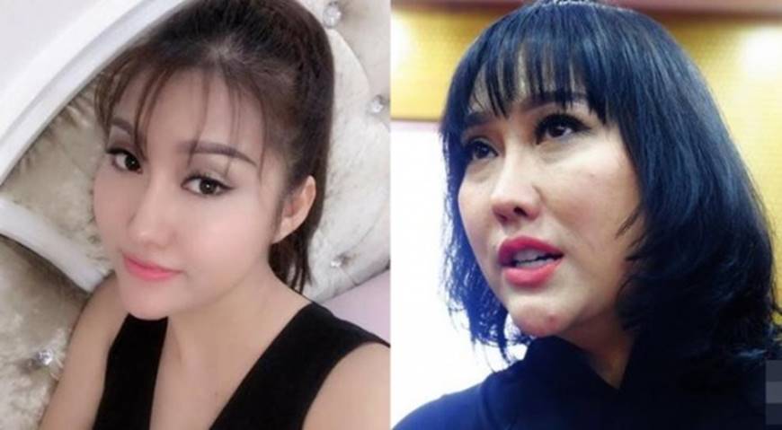 Sau khi dao kéo sao Việt nhìn ra sao nếu không photoshop, make up?-16