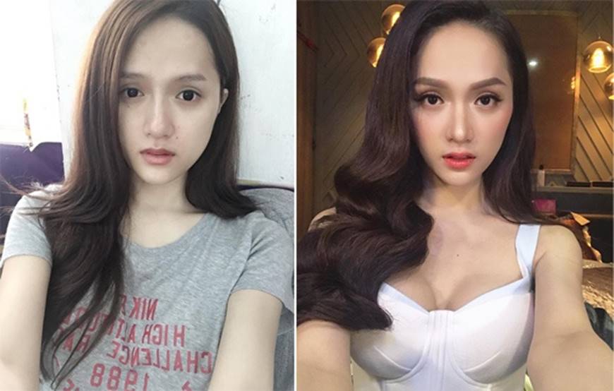 Sau khi dao kéo sao Việt nhìn ra sao nếu không photoshop, make up?-23