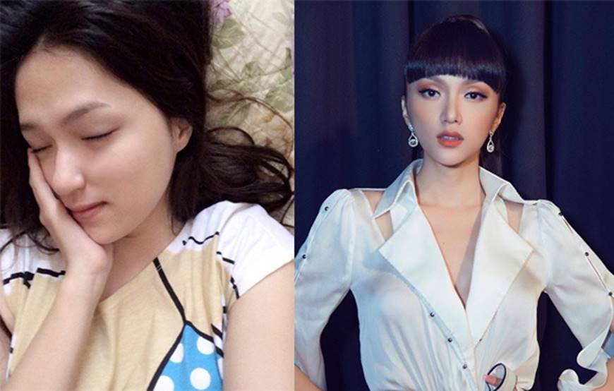 Sau khi dao kéo sao Việt nhìn ra sao nếu không photoshop, make up?-24