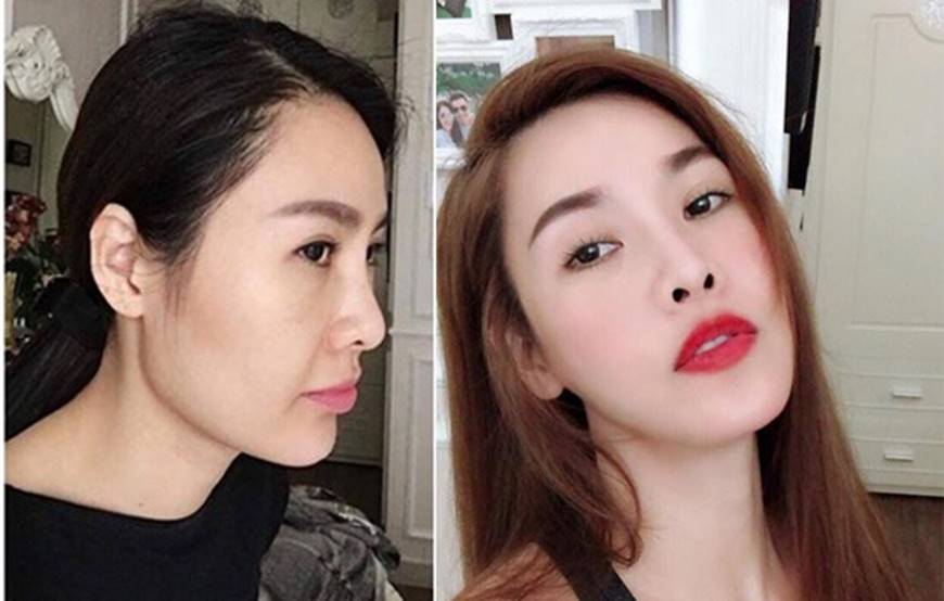 Sau khi dao kéo sao Việt nhìn ra sao nếu không photoshop, make up?-25