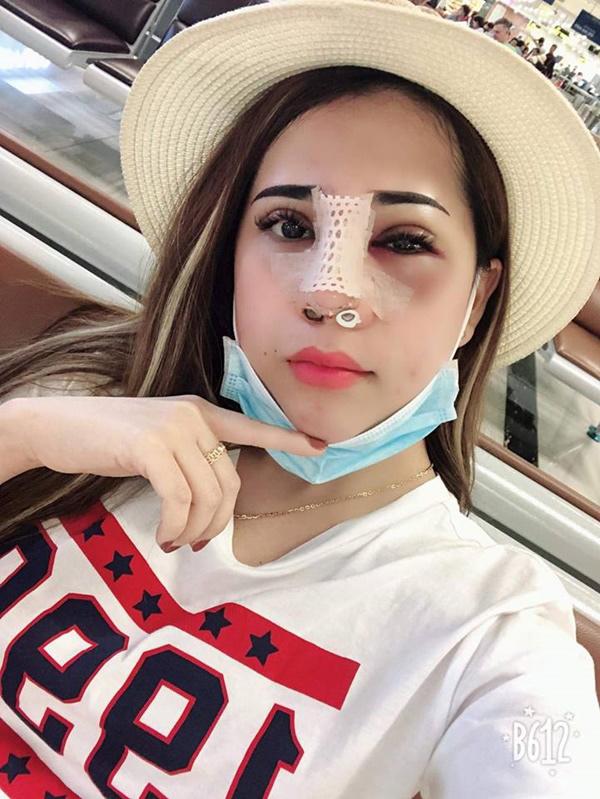 Lại thêm một vụ sửa mặt nát bét rồi lên mạng than, có trời mới cứu được-2