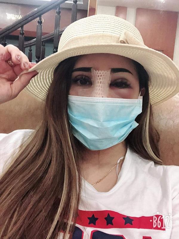 Lại thêm một vụ sửa mặt nát bét rồi lên mạng than, có trời mới cứu được-3