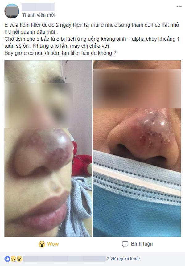 Lại thêm một vụ sửa mặt nát bét rồi lên mạng than, có trời mới cứu được-6