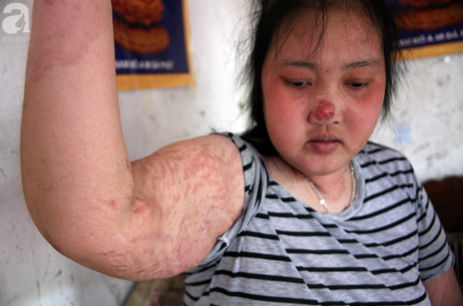 Người mẹ trẻ ung thư giai đoạn cuối ở Hà Nam: Đã rất lâu rồi gia đình em mới có tiền mua sữa cho 3 cô con gái-6