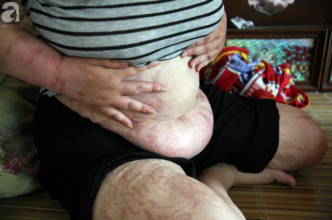 Người mẹ trẻ ung thư giai đoạn cuối ở Hà Nam: Đã rất lâu rồi gia đình em mới có tiền mua sữa cho 3 cô con gái-7