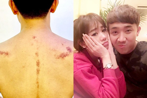 Những lần Trấn Thành công khai bêu xấu Hari Won-1