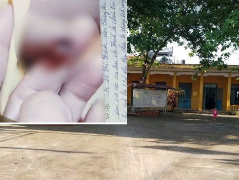 Thực hư thông tin cô giáo mầm non vụt chảy máu bộ phận sinh dục bé trai 3 tuổi-1