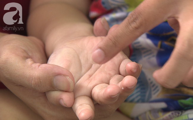 Chưa hết lo dịch tay chân miệng, hàng loạt bà mẹ ở Đồng Nai đã hại con” mắc bệnh sởi nặng vì quên tiêm vắc xin-4