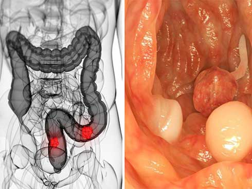 Bé gái mang khối u hiếm, thế giới chưa đến 20 ca-2
