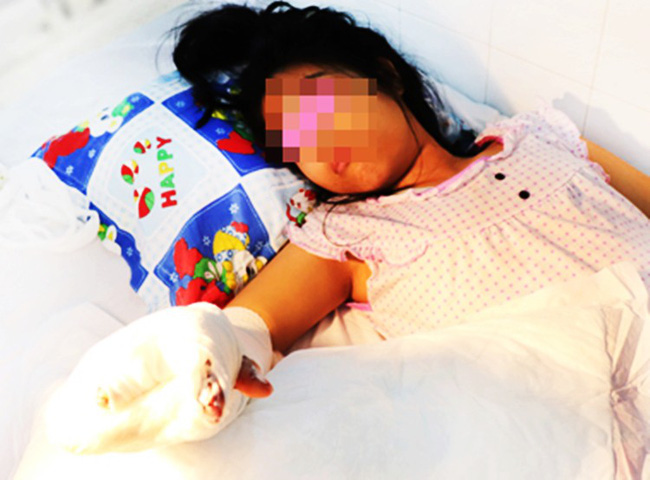 Theo mẹ và em song sinh đến trường, bé gái 14 tuổi ở Bình Dương bị xe container cán nát bàn tay-1