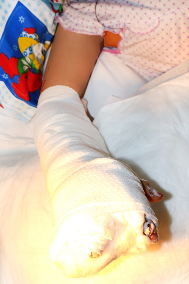 Theo mẹ và em song sinh đến trường, bé gái 14 tuổi ở Bình Dương bị xe container cán nát bàn tay-3