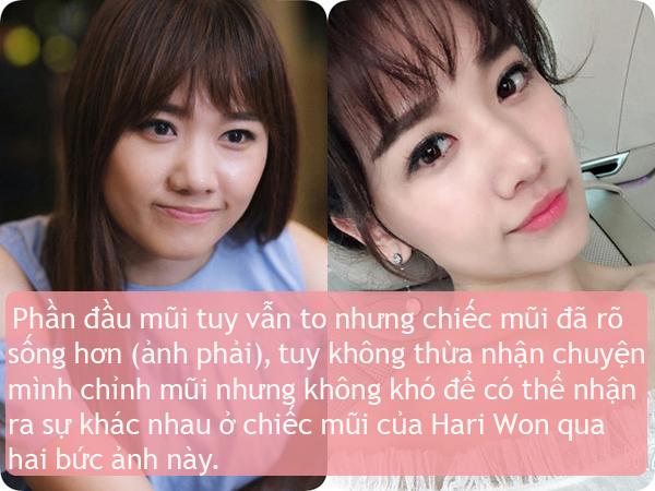 Ít ai biết điểm chung nhan sắc của vợ 3 danh hài hot nhất showbiz Việt-5