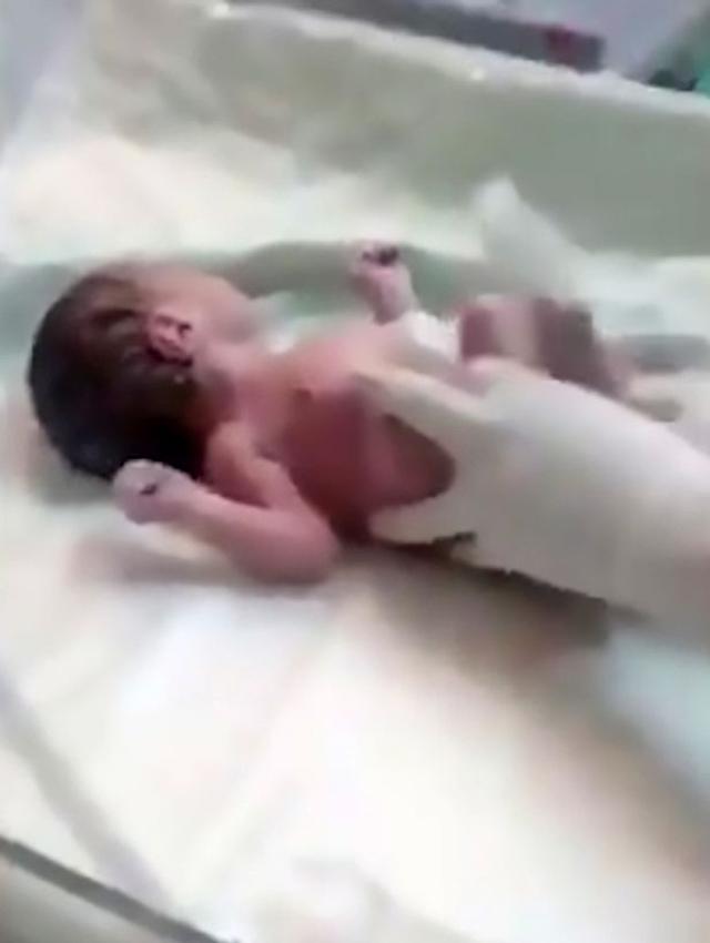 Tưởng có con vật chết trong túi nilon, người phụ nữ mở ra cứu được một mạng người-2