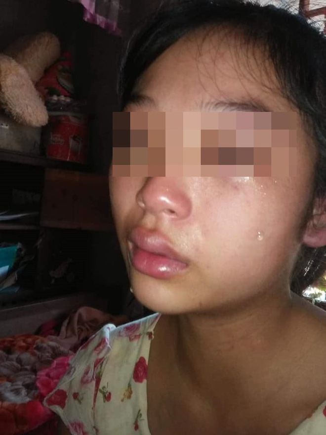 Vợ 16 tuổi lên mạng cầu cứu vì bị chồng siết cổ, đánh đuổi ra khỏi nhà-3