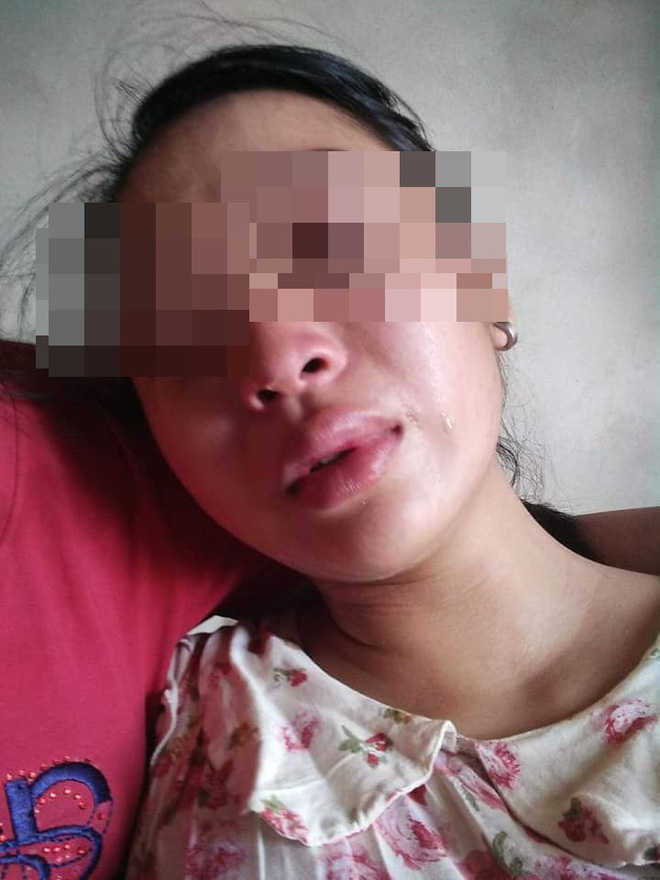 Vợ 16 tuổi lên mạng cầu cứu vì bị chồng siết cổ, đánh đuổi ra khỏi nhà-4