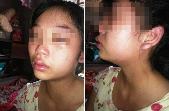 Mẹ trẻ 16 tuổi đăng Facebook cầu cứu vì bị chồng liên tục bạo hành-3