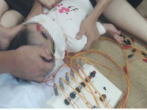 Rét đậm khắc nghiệt, nhiều trẻ liệt mặt, méo miệng vì nhiễm lạnh đột ngột-4