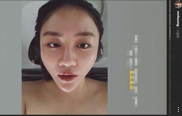 Bí mật đằng sau những chiếc cằm nhọn của sao Việt khiến ai cũng muốn thẩm mỹ-10