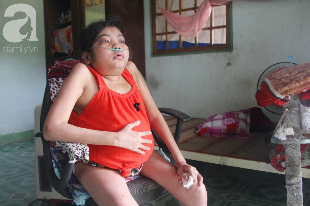 Xót cảnh cô gái trẻ 12 năm ngủ ngồi, chỉ mong chết đi vì không muốn bố mẹ nợ hoài tới nỗi không thể chữa bệnh cho em-2