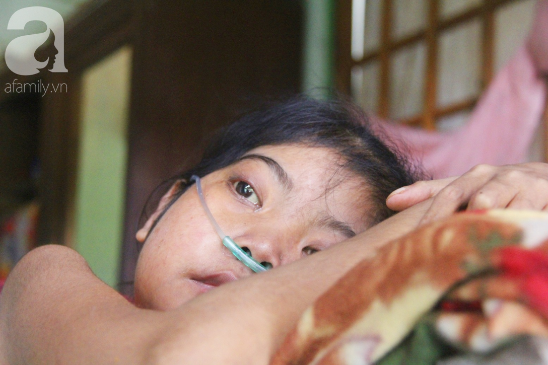 Xót cảnh cô gái trẻ 12 năm ngủ ngồi, chỉ mong chết đi vì không muốn bố mẹ nợ hoài tới nỗi không thể chữa bệnh cho em-4