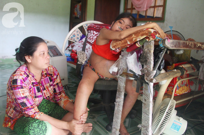 Xót cảnh cô gái trẻ 12 năm ngủ ngồi, chỉ mong chết đi vì không muốn bố mẹ nợ hoài tới nỗi không thể chữa bệnh cho em-6