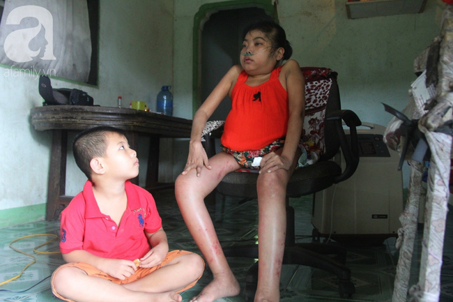 Xót cảnh cô gái trẻ 12 năm ngủ ngồi, chỉ mong chết đi vì không muốn bố mẹ nợ hoài tới nỗi không thể chữa bệnh cho em-12