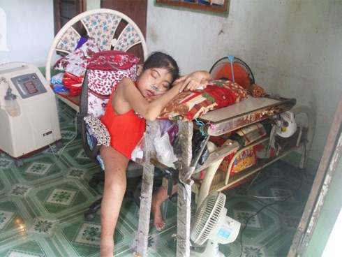 Xót cảnh cô gái trẻ 12 năm ngủ ngồi, chỉ mong chết đi vì không muốn bố mẹ nợ hoài tới nỗi không thể chữa bệnh cho em