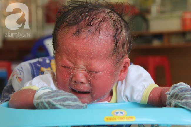 Mẹ mắc bệnh hiểm này khi mang thai vô tình đe dọa tính mạng của con: Cảnh báo căn bệnh gây biến dạng xương, tử vong trẻ sơ sinh-2