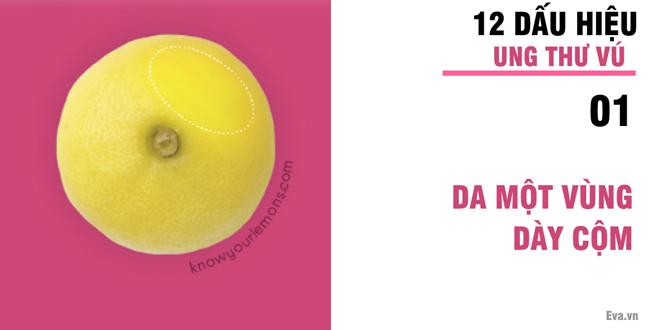 Nhờ vào bức ảnh 12 quả chanh, người phụ nữ bất ngờ phát hiện bị ung thư vú-4