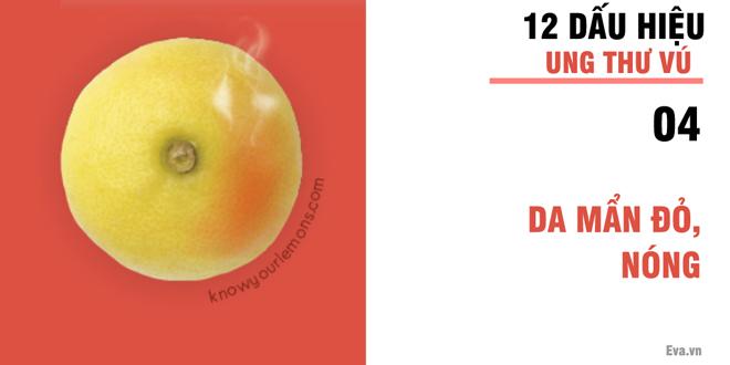 Nhờ vào bức ảnh 12 quả chanh, người phụ nữ bất ngờ phát hiện bị ung thư vú-5