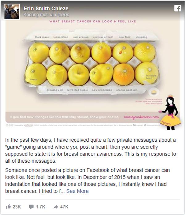Nhờ vào bức ảnh 12 quả chanh, người phụ nữ bất ngờ phát hiện bị ung thư vú-1