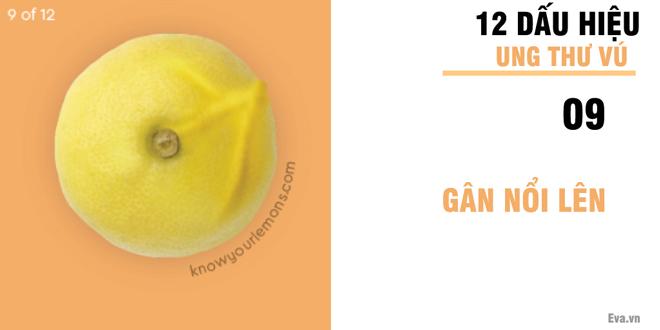 Nhờ vào bức ảnh 12 quả chanh, người phụ nữ bất ngờ phát hiện bị ung thư vú-10