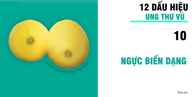 Nhờ vào bức ảnh 12 quả chanh, người phụ nữ bất ngờ phát hiện bị ung thư vú-11