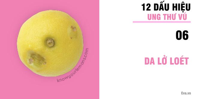 Nhờ vào bức ảnh 12 quả chanh, người phụ nữ bất ngờ phát hiện bị ung thư vú-7