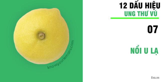 Nhờ vào bức ảnh 12 quả chanh, người phụ nữ bất ngờ phát hiện bị ung thư vú-8