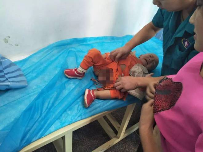 Bé trai 2 tuổi bị kẹt dương vật ở thang cuốn, ai nhìn hình ảnh cũng xót-4