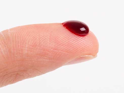 Không cần thực phẩm chức năng, chỉ áp dụng những điều này, máu trong cơ thể ắt tự sạch-1