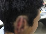 Người đàn ông ở Đồng Nai bị cắt ngang bụng, thủng ruột kinh hoàng do máy cưa vướng vào áo-6
