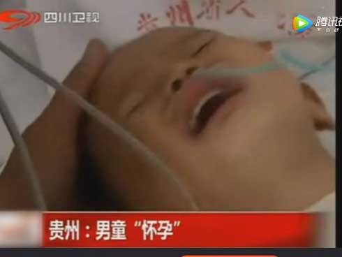 Bé trai 2 tuổi đột nhiên ốm nghén và mang thai khó hiểu-2